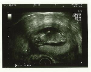 echo 30 september 2014