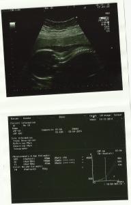 echo 18 december 2014