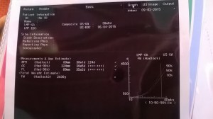 WP_20150312_15_44_40_Pro